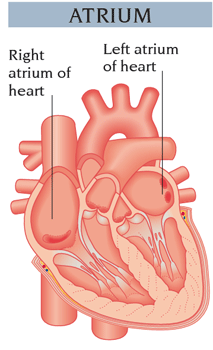 Atrium, Atrial fibrillation
